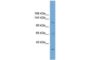 WB Suggested Anti-ZNF624 Antibody Titration: 0.
