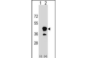 Western blot analysis of CD1B (arrow) using rabbit polyclonal CD1B Antibody (N-term) (ABIN1539475 and ABIN2849952). (CD1b Antikörper  (N-Term))