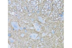 Immunohistochemistry of paraffin-embedded Mouse spinal cord using ATP1B2 Polyclonal Antibody at dilution of 1:100 (40x lens). (ATP1B2 Antikörper)