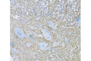 Immunohistochemistry of paraffin-embedded Mouse spinal cord using ATP1B2 Polyclonal Antibody at dilution of 1:100 (40x lens).