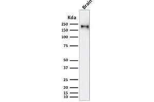 Western Blot Analysis of human brain tissue lysate using Neurofilament Mouse Recombinant Monoclonal Antibody (rNF421). (Rekombinanter NEFH Antikörper)