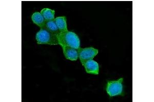 anti-ATP Citrate Lyase (ACLY) (AA 1-180) antibody