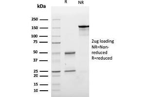 SDS-PAGE (SDS) image for anti-Cadherin 1, Type 1, E-Cadherin (Epithelial) (CDH1) (AA 567-691) antibody (ABIN6941293)