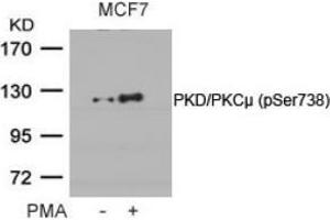 Image no. 2 for anti-Protein Kinase D1 (PRKD1) (pSer738) antibody (ABIN196754) (PKC mu Antikörper  (pSer738))