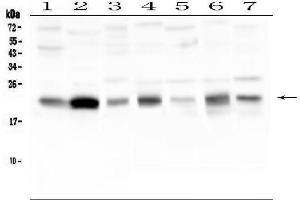 Western blot analysis of CAV3 using anti-CAV3 antibody (ABIN6719285).