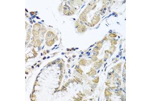 Immunohistochemistry of paraffin-embedded human stomach using IFNL3 antibody (ABIN6293714) at dilution of 1:100 (40x lens). (IL28B Antikörper)