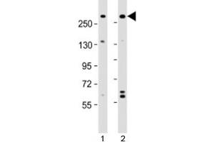 Western blot testing of human 1) A431 and 2) U-2OS cell lysate with NBAS antibody at 1:2000. (NBAS Antikörper  (AA 628-661))