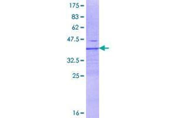 DPP9 Protein (AA 24-119) (GST tag)