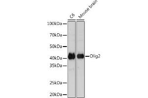 Western blot analysis of extracts of various cell lines, using Olig2 Rabbit mAb (ABIN7269090) at 1:1000 dilution. (OLIG2 Antikörper)