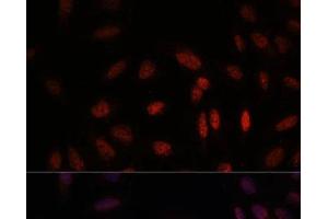 Immunofluorescence analysis of U-2 OS cells using WDR18 Polyclonal Antibody at dilution of 1:100.
