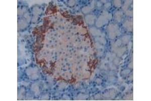 Detection of CFH in Rat Pancreas Tissue using Polyclonal Antibody to Complement Factor H (CFH) (Complement Factor H Antikörper  (AA 975-1217))