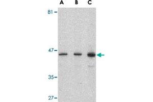 Western blot analysis of PSEN1 in human brain lysate with PSEN1 polyclonal antibody  at (A) 0.