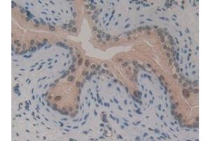 Detection of GLI3 in Mouse Vas Deferens Tissue using Polyclonal Antibody to GLI Family Zinc Finger Protein 3 (GLI3) (GLI Family Zinc Finger Protein 3 (AA 303-561) Antikörper)