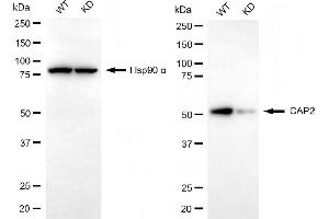 anti-Adenylyl Cyclase Associated Protein 2 (CAP2) antibody