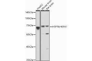 Western blot analysis of extracts of various cell lines, using HSP70/HSP antibody  at 1:1000 dilution. (HSP70 1A Antikörper  (C-Term))