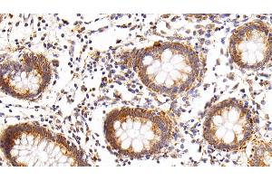 Immunohistochemistry (IHC) image for anti-Eosinophil Cationic Protein (ECP) (AA 30-154) antibody (ABIN7434023)