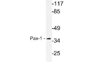 Western blot (WB) analysis of Pax-1 antibody in extracts from HeLa cells. (PAX1 Antikörper)