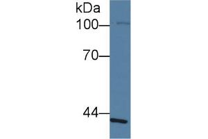 Western Blot; Sample: Human Lung lysate; ;Primary Ab: 1µg/ml Rabbit Anti-Human SLFN5 Antibody;Second Ab: 0. (SLFN5 Antikörper  (AA 658-891))