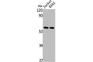 Western Blot analysis of Jurkat K562 cells using SS-56 Polyclonal Antibody (TRIM68 Antikörper  (Internal Region))