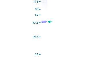 GUK1 Protein (AA 1-197) (GST tag)