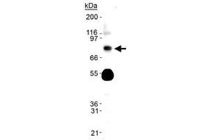 Western blot analysis of Phospho-Slc9a3 in human kidney lysate using with Slc9a3 (phospho S552) monoclonal antibody, clone 14D5 . (SLC9A3 Antikörper  (pSer552))