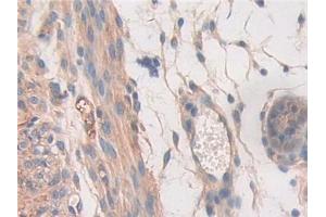 DAB staining on IHC-P; Samples: Mouse Uterus Tissue (STAT2 Antikörper  (AA 658-912))