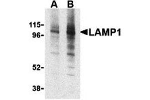 Western Blotting (WB) image for anti-Lysosomal-Associated Membrane Protein 1 (LAMP1) (Middle Region) antibody (ABIN1030977) (LAMP1 Antikörper  (Middle Region))