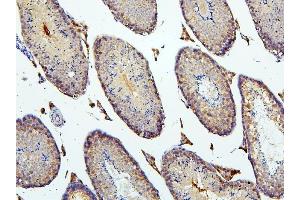 IHC analysis of BUB1B using anti-BUB1B antibody (ABIN7600962). (BUB1B Antikörper  (AA 26-448))