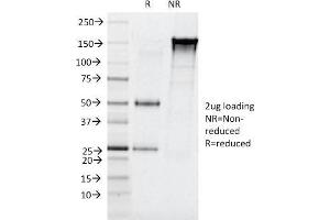 SDS-PAGE (SDS) image for anti-Elastase 3B, Pancreatic (ELA3B) (AA 82-238) antibody (ABIN6939418)