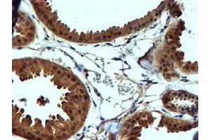 Immunohistochemical staining of paraffin-embedded Human breast tissue using anti-C2orf56 mouse monoclonal antibody. (NDUFAF7 Antikörper)
