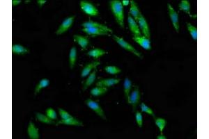 Immunofluorescence staining of Hela cells with ABIN7147441 at 1:100, counter-stained with DAPI. (CEP97 Antikörper  (AA 719-854))