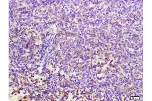 Formalin-fixed and paraffin embedded mouse lymphoma labeled with Anti-MuRF1/Trim63 Polyclonal Antibody, Unconjugated (ABIN687697) at 1:200 followed by conjugation to the secondary antibody and DAB staining. (CD7 Antikörper  (AA 181-240))