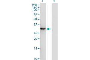 Western Blot analysis of SSX2 expression in transfected 293T cell line by SSX2 monoclonal antibody (M01), clone 1A4.