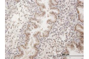Immunoperoxidase of purified MaxPab antibody to FKBP5 on formalin-fixed paraffin-embedded human endometrium.
