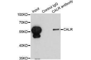 Immunoprecipitation analysis of 200ug extracts of HepG2 cells using 1ug CALR antibody. (Calreticulin Antikörper)