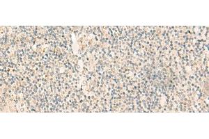 Immunohistochemistry of paraffin-embedded Human tonsil tissue using NGEF Polyclonal Antibody at dilution of 1:35(x200) (NGEF Antikörper)