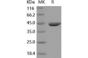 Western Blotting (WB) image for Aminoacylase 1 (ACY1) (Active) protein (His tag) (ABIN7320441)
