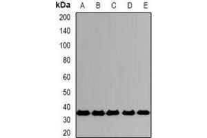 Western blot analysis of CD319 expression in A549 (A), SKOV3 (B), mouse spleen (C), mouse lung (D), rat testis (E) whole cell lysates. (SLAMF7 Antikörper)