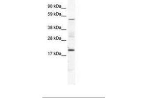 Image no. 1 for anti-Casein Kinase 1, gamma 1 (CSNK1G1) (AA 279-328) antibody (ABIN202567) (CSNK1G1 Antikörper  (AA 279-328))