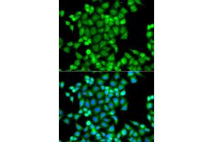Immunofluorescence analysis of A549 cells using PAK2 antibody. (PAK2 Antikörper)
