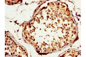 IHC image of ABIN7170472 diluted at 1:200 and staining in paraffin-embedded human testis tissue performed on a Leica BondTM system. (SPA17 Antikörper  (AA 1-146))