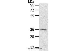 Western blot analysis of A431 cell, using PDLIM4 Polyclonal Antibody at dilution of 1:400 (PDLIM4 Antikörper)