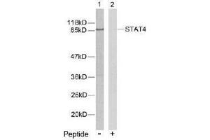 Image no. 2 for anti-Signal Transducer and Activator of Transcription 4 (STAT4) (Tyr693) antibody (ABIN197179) (STAT4 Antikörper  (Tyr693))