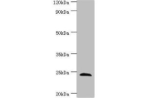 Western blot All lanes: SOST antibody at 4 μg/mL + Hela whole cell lysate Secondary Goat polyclonal to rabbit IgG at 1/10000 dilution Predicted band size: 24 kDa Observed band size: 24 kDa (Sclerostin Antikörper  (AA 24-213))