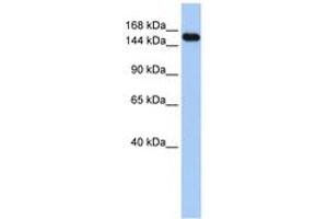 Image no. 1 for anti-Ubiquitin Protein Ligase E3A (ube3a) (C-Term) antibody (ABIN6743133) (ube3a Antikörper  (C-Term))
