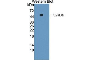 Figure. (CCBL1 Antikörper  (AA 1-422))