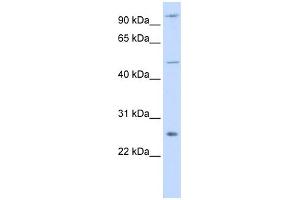 WB Suggested Anti-TRAF4 Antibody Titration:  0. (TRAF4 Antikörper  (Middle Region))