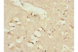 Immunohistochemistry of paraffin-embedded human brain tissue using ABIN7143394 at dilution of 1:100 (LPHN2 Antikörper  (AA 400-480))