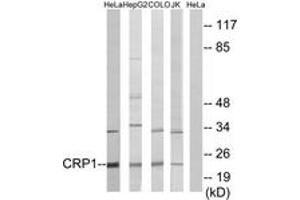 Western blot analysis of extracts from HeLa/HepG2/COLO/Jurkat cells, using CRP1 Antibody. (CSRP1 Antikörper  (AA 51-100))