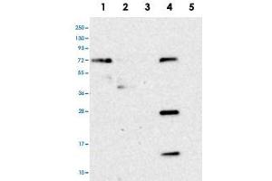 Western blot analysis of Lane 1: RT-4, Lane 2: U-251 MG, Lane 3: Human Plasma, Lane 4: Liver, Lane 5: Tonsil with HS2ST1 polyclonal antibody .